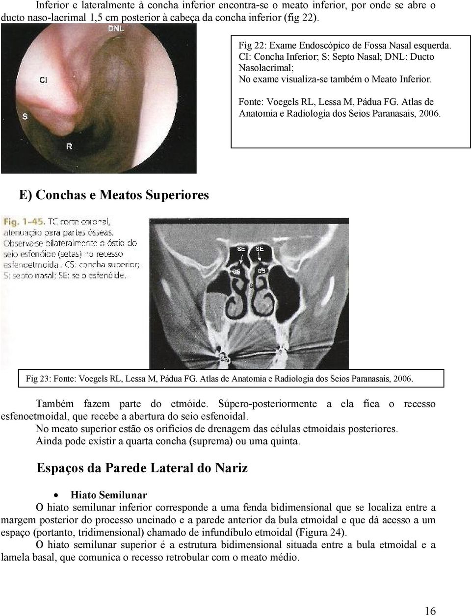 Atlas de Anatomia e Radiologia dos Seios Paranasais, 2006. E) Conchas e Meatos Superiores Fig 23: Fonte: Voegels RL, Lessa M, Pádua FG. Atlas de Anatomia e Radiologia dos Seios Paranasais, 2006.