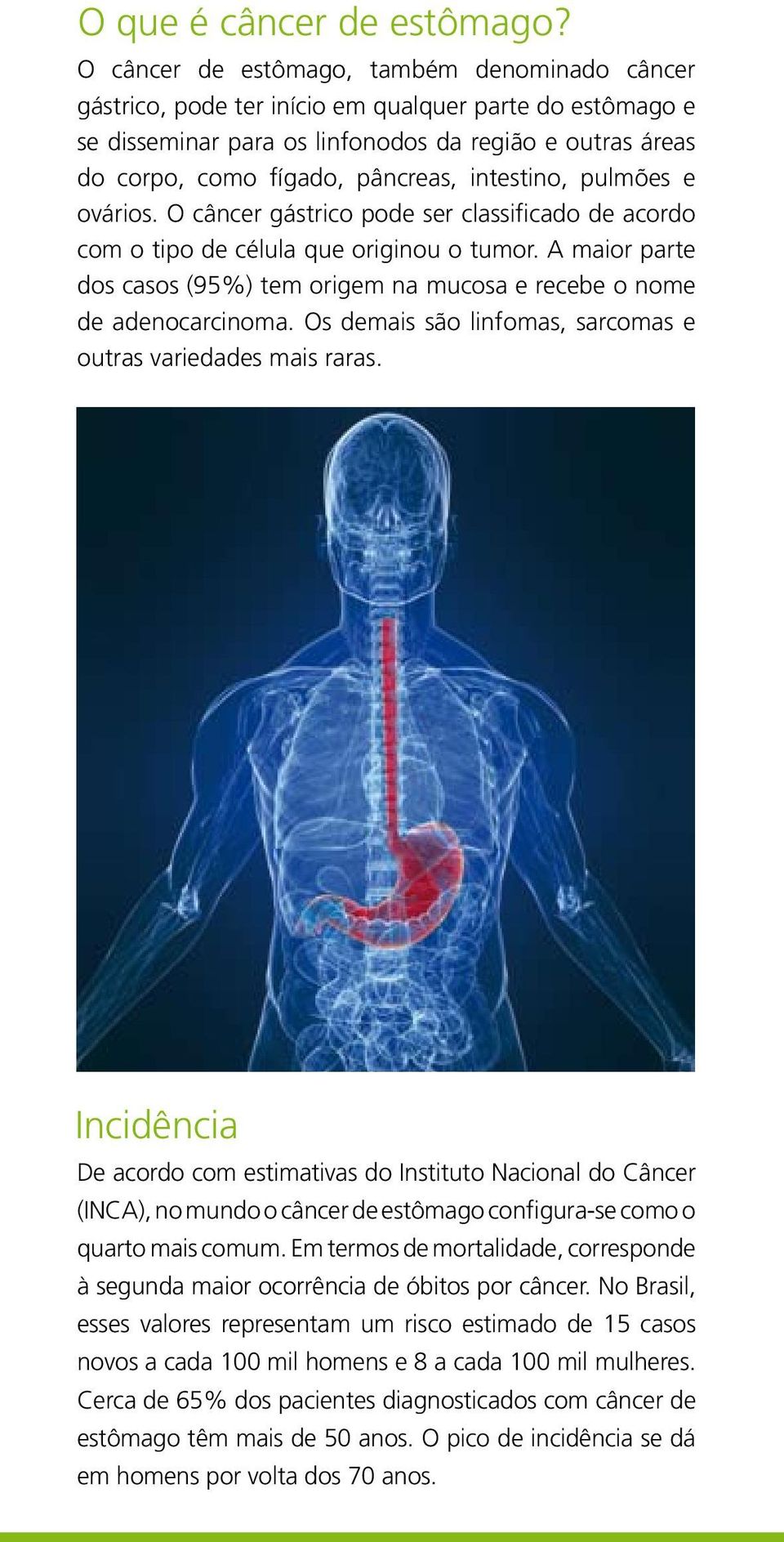 intestino, pulmões e ovários. O câncer gástrico pode ser classificado de acordo com o tipo de célula que originou o tumor.