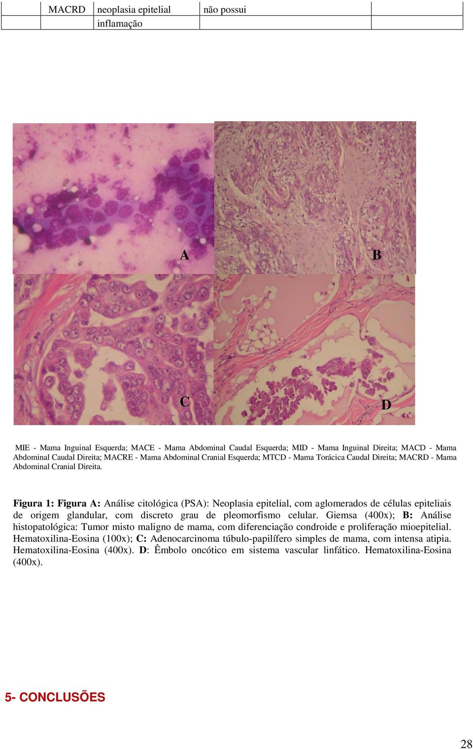 Figura 1: Figura A: Análise citológica (PSA): Neoplasia epitelial, com aglomerados de células epiteliais de origem glandular, com discreto grau de pleomorfismo celular.