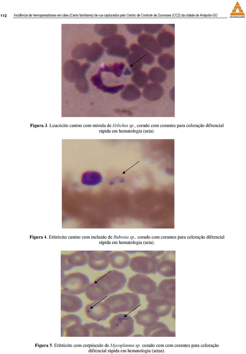 , corado com corantes para coloração difrencial rápida em hematologia (seta). Figura 4. Eritrócito canino com inclusão de Babesia sp.