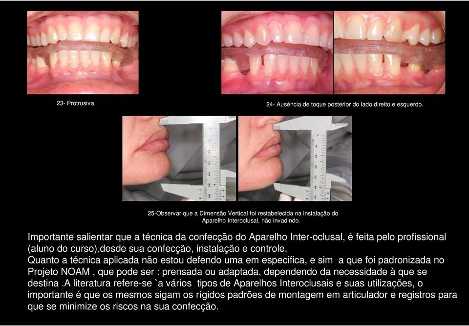 Quanto a técnica aplicada não estou defendo uma em especifica, e sim a que foi padronizada no Projeto NOAM, que pode ser : prensada ou adaptada, dependendo da necessidade à que se destina.