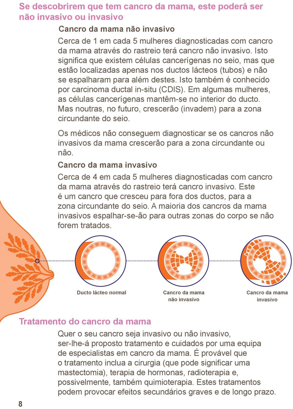 Isto também é conhecido por carcinoma ductal in-situ (CDIS). Em algumas mulheres, as células cancerígenas mantêm-se no interior do ducto.