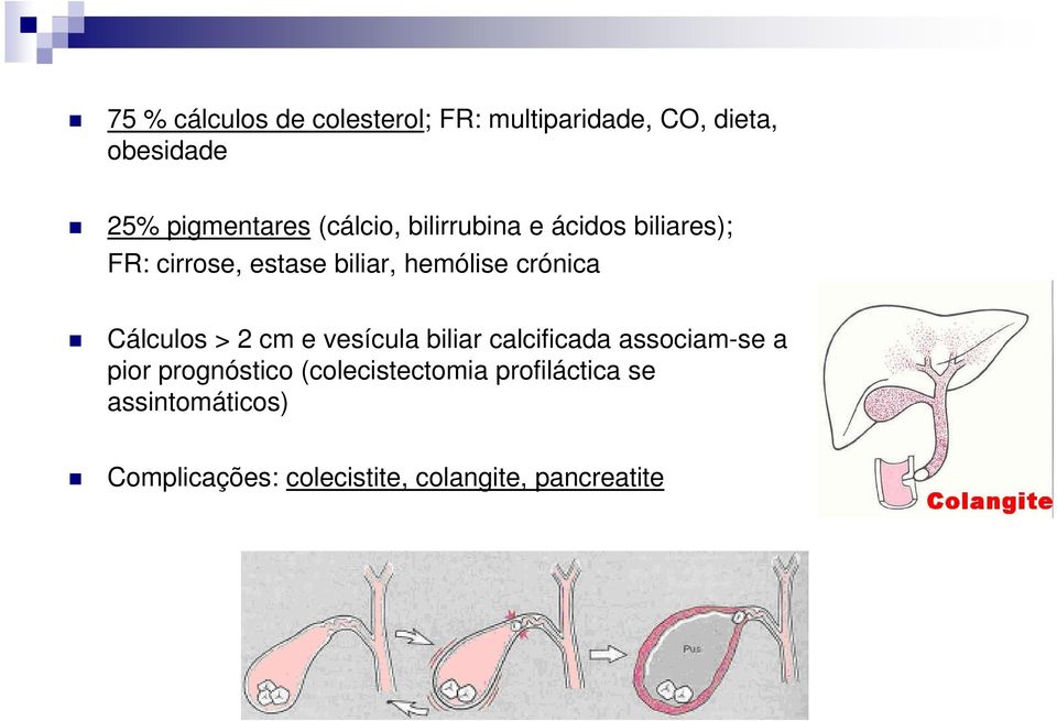 Cálculos > 2 cm e vesícula biliar calcificada associam-se a pior prognóstico