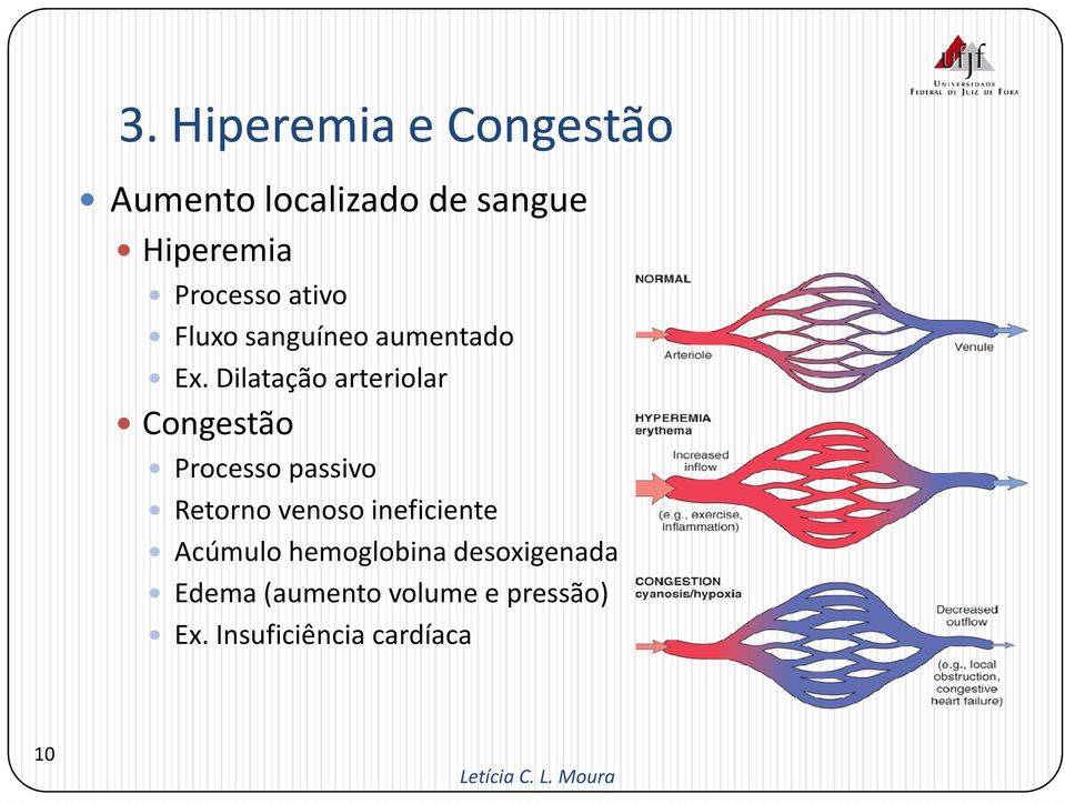 Dilatação arteriolar Congestão Processo passivo Retorno venoso