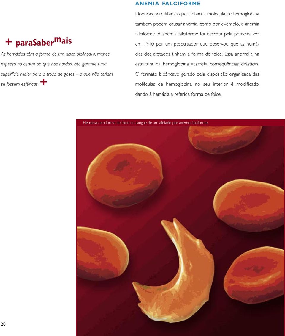 A anemia falciforme foi descrita pela primeira vez em 1910 por um pesquisador que observou que as hemácias dos afetados tinham a forma de foice.