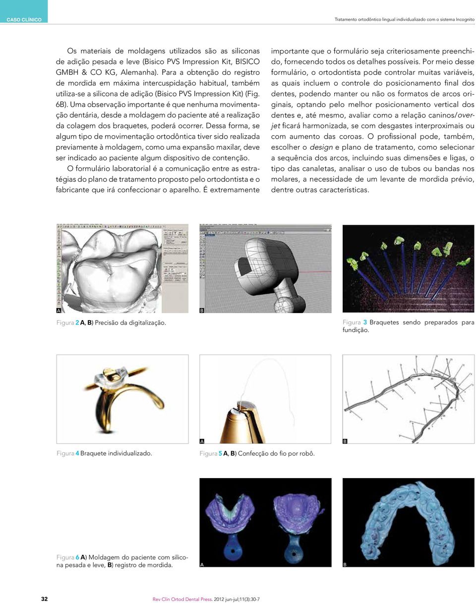 Uma observação importante é que nenhuma movimentação dentária, desde a moldagem do paciente até a realização da colagem dos braquetes, poderá ocorrer.