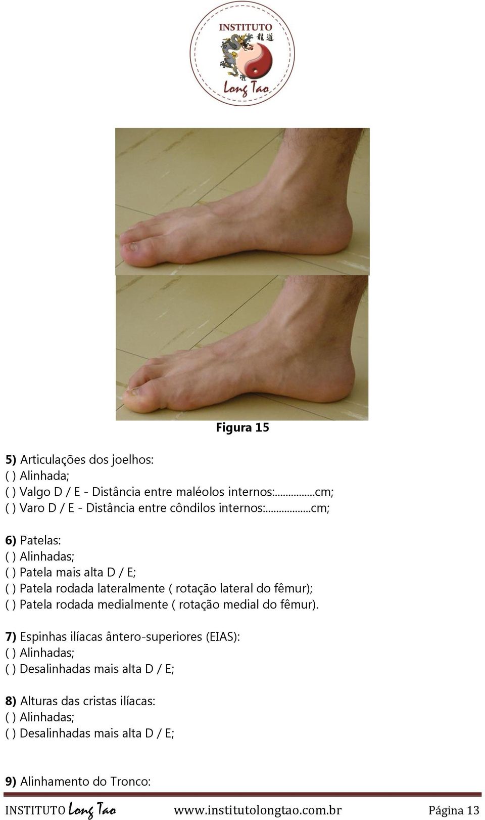 ..cm; 6) Patelas: ( ) Alinhadas; ( ) Patela mais alta D / E; ( ) Patela rodada lateralmente ( rotação lateral do fêmur); ( ) Patela rodada medialmente