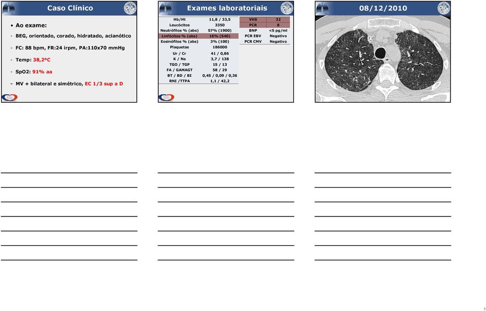 % (abs) 57% (1900) Linfócitos % (abs) 16% (540) Eosinófilos % (abs) 3% (100) Plaquetas 186000 Ur / Cr 41 / 0,86 K / Na 3,7 / 138 TGO /
