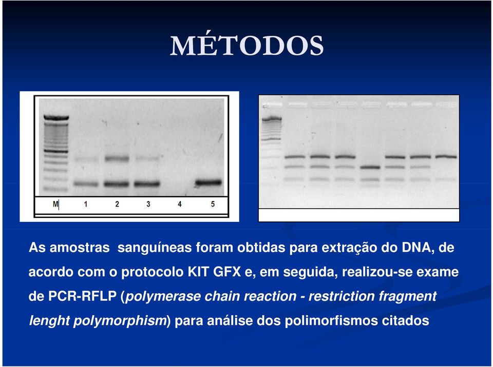 realizou-se exame de PCR-RFLP (polymerase chain reaction -