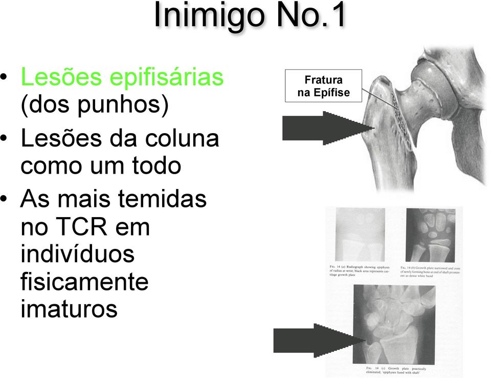 Lesões da coluna como um todo As mais