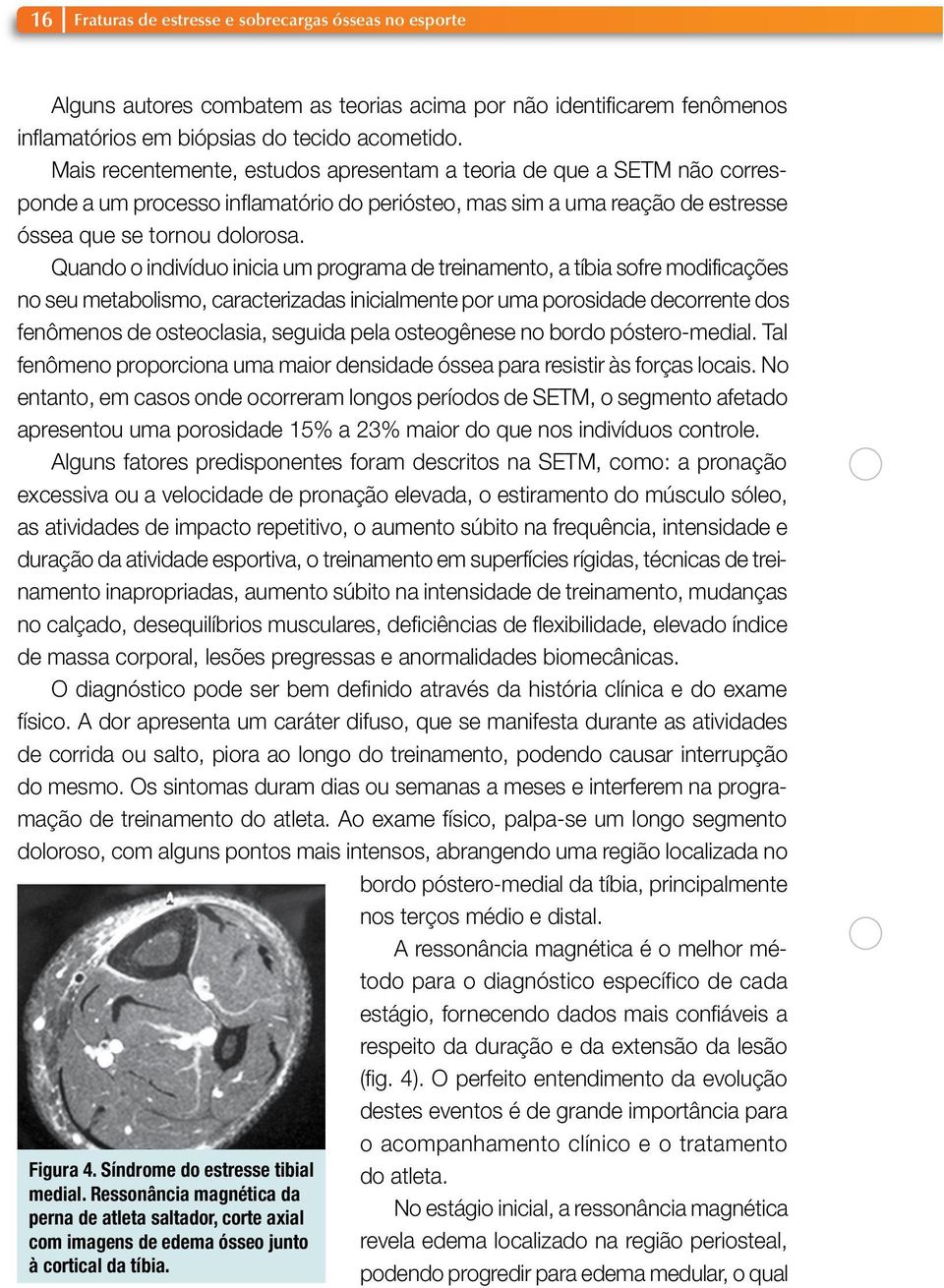 Quando o indivíduo inicia um programa de treinamento, a tíbia sofre modificações no seu metabolismo, caracterizadas inicialmente por uma porosidade decorrente dos fenômenos de osteoclasia, seguida