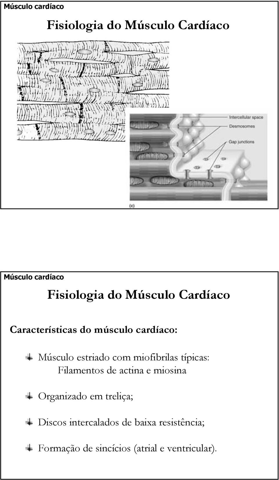miofibrilas típicas: Filamentos de actina e miosina Organizado em treliça;