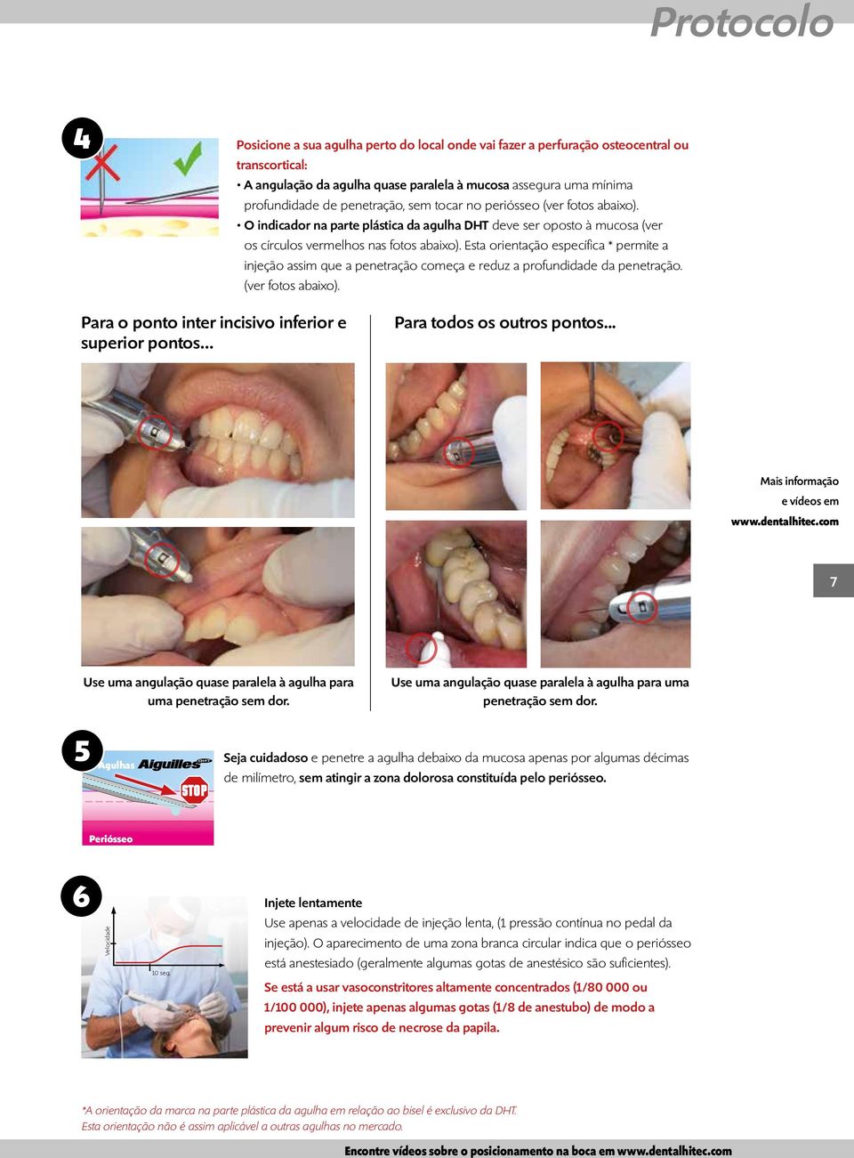 Esta orientação específica * permite a injeção assim que a penetração começa e reduz a profundidade da penetração. (ver fotos abaixo).