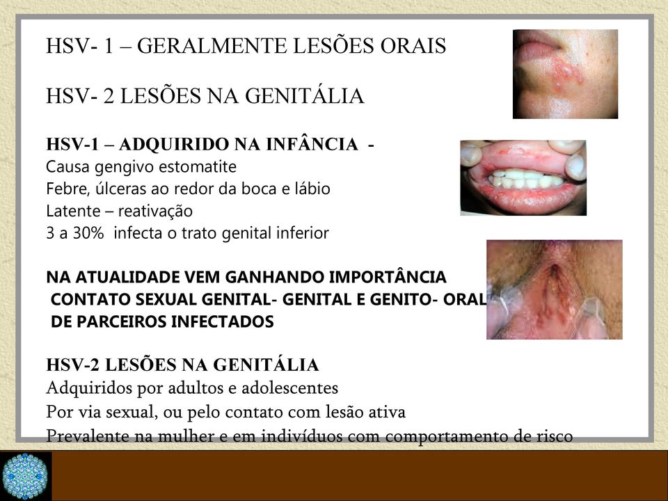 IMPORTÂNCIA CONTATO SEXUAL GENITAL- GENITAL E GENITO- ORAL DE PARCEIROS INFECTADOS HSV-2 LESÕES NA GENITÁLIA Adquiridos por