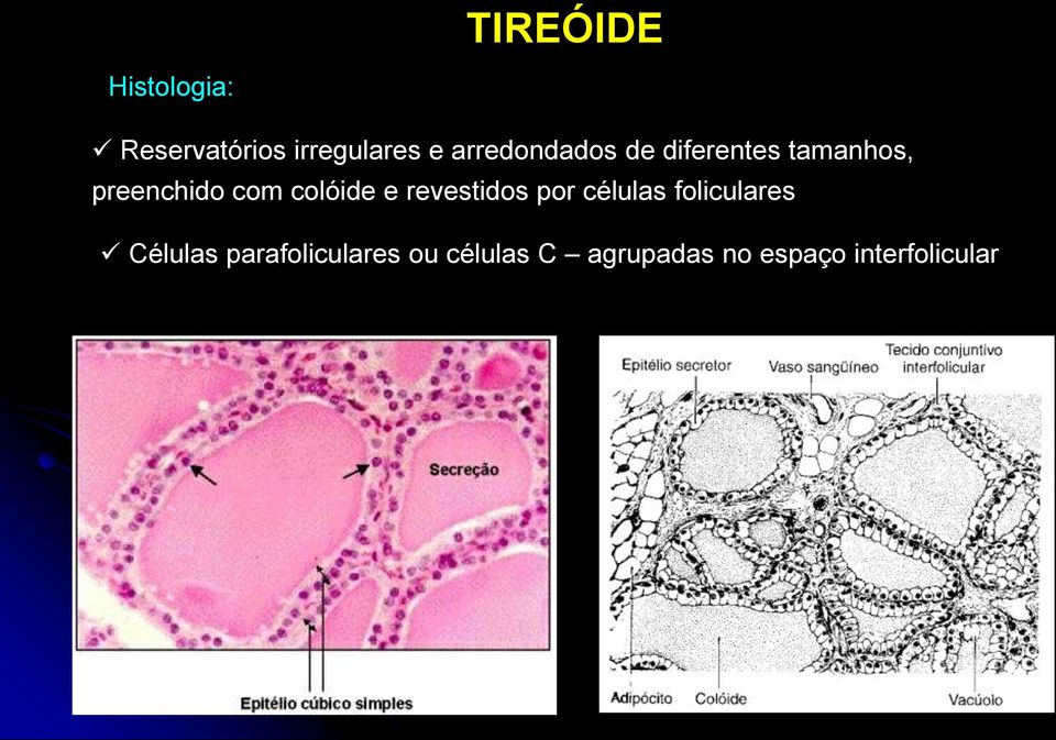 colóide e revestidos por células foliculares Células