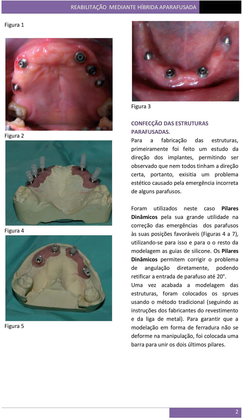 causado pela emergência incorreta de alguns parafusos.