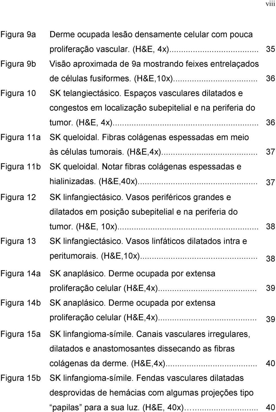 Fibras colágenas espessadas em meio às células tumorais. (H&E,4x)... 37 Figura 11b SK queloidal. Notar fibras colágenas espessadas e hialinizadas. (H&E,40x).