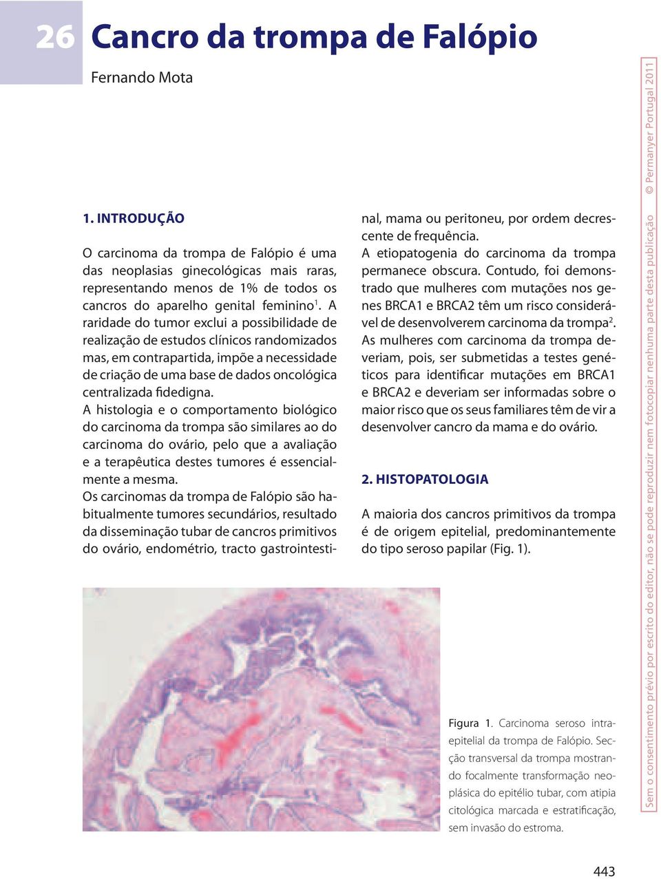 A raridade do tumor exclui a possibilidade de realização de estudos clínicos randomizados mas, em contrapartida, impõe a necessidade de criação de uma base de dados oncológica centralizada fidedigna.