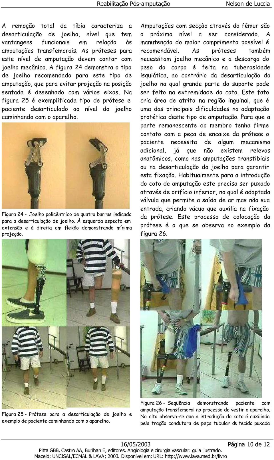 A figura 24 demonstra o tipo de joelho recomendado para este tipo de amputação, que para evitar projeção na posição sentada é desenhado com vários eixos.