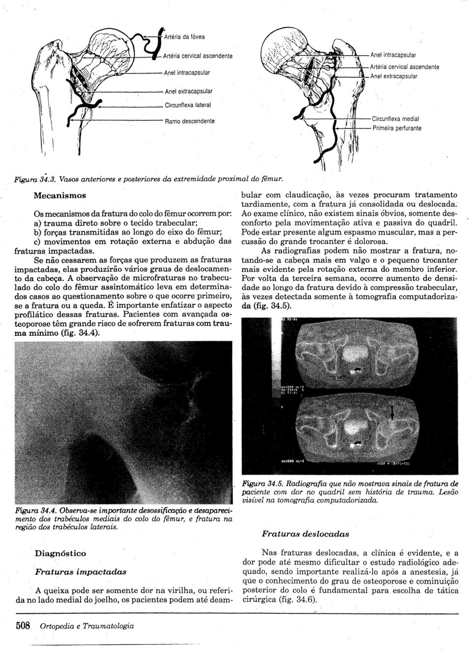 Mecanismos Os mecanismos dafratura do colo do fêmur ocorrem por: a) trauma direto sobre o tecido trabecular; b) forças transmitidas ao longo do eixo do fêmur; c) movimentos em rotação externa e