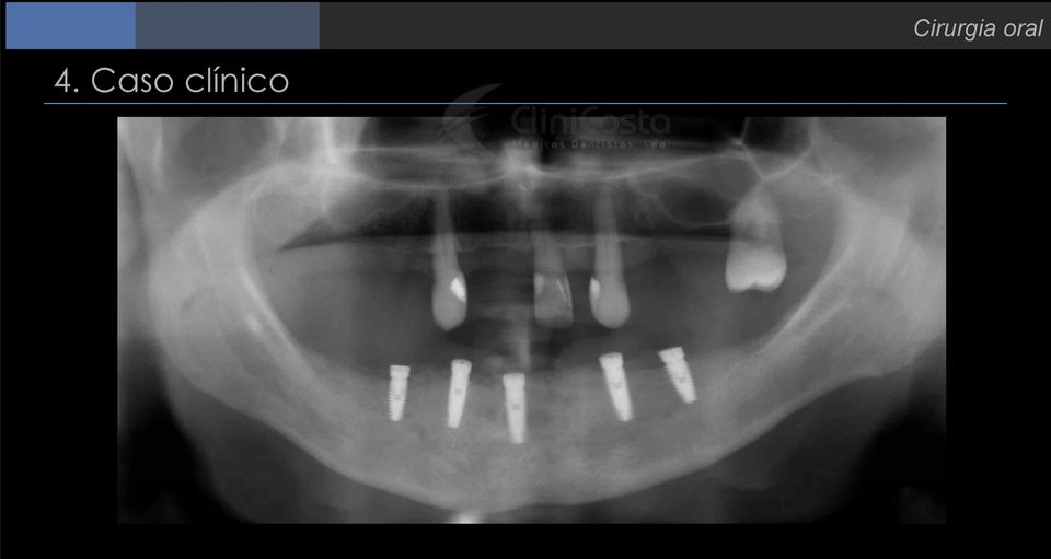 Cirurgia