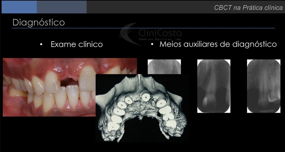 Exame clínico Meios