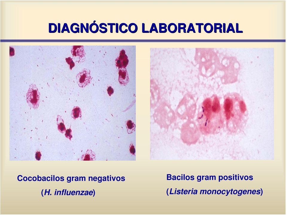 (H. influenzae) Bacilos gram
