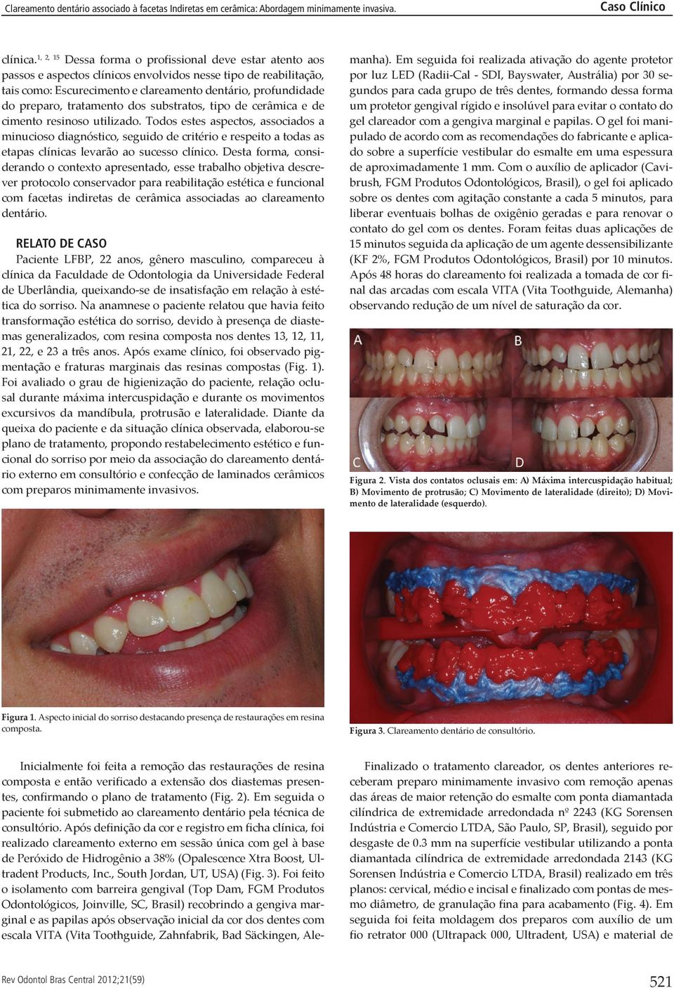 tratamento dos substratos, tipo de cerâmica e de cimento resinoso utilizado.