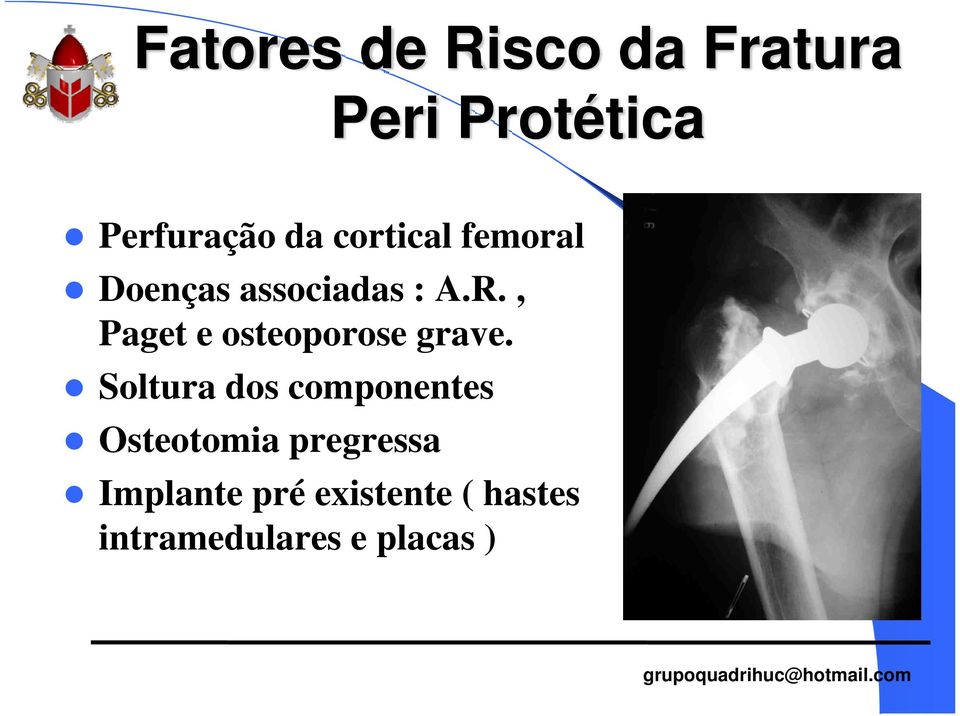 , Paget e osteoporose grave.