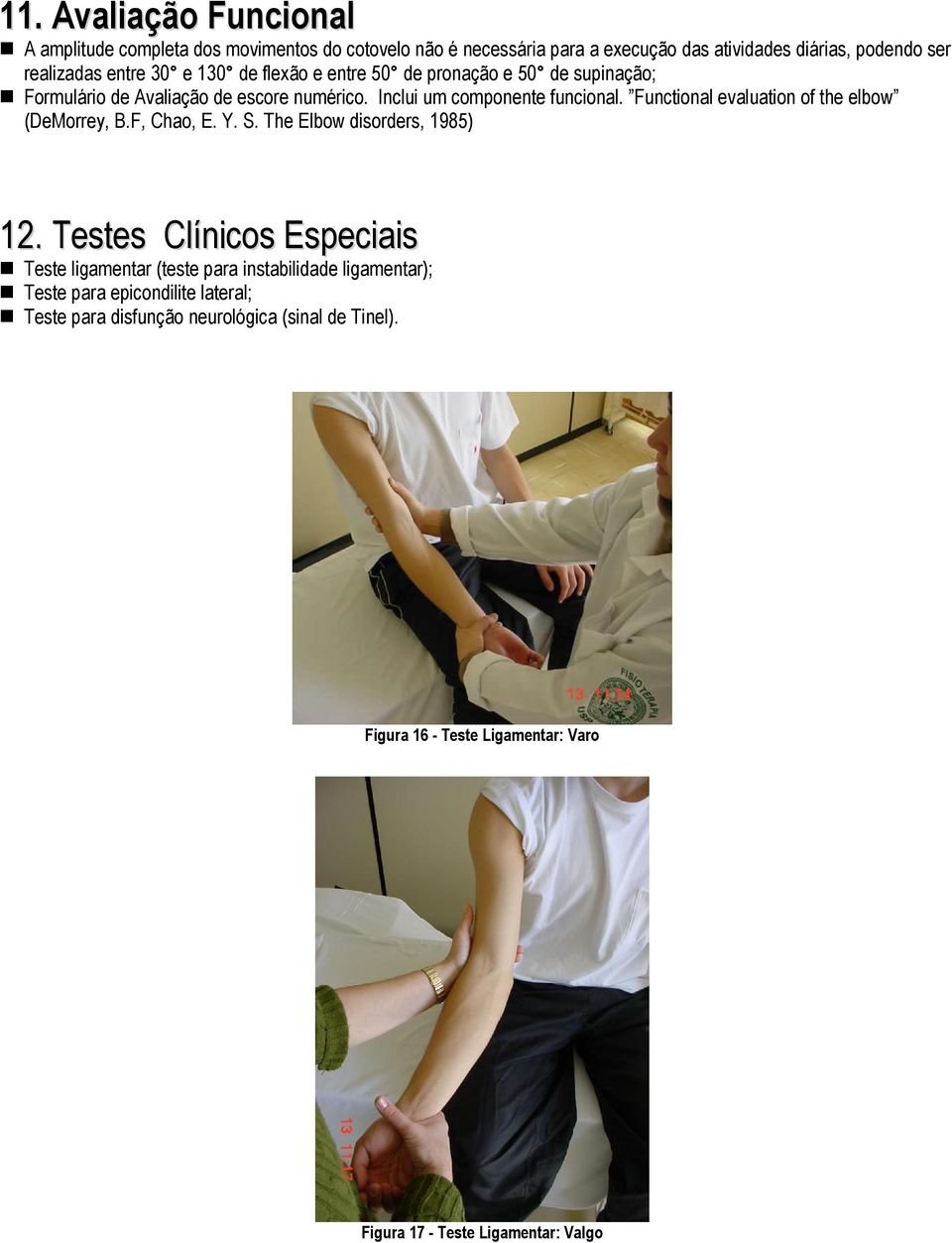 Functional evaluation of the elbow (DeMorrey, B.F, Chao, E. Y. S. The Elbow disorders, 1985) 12.