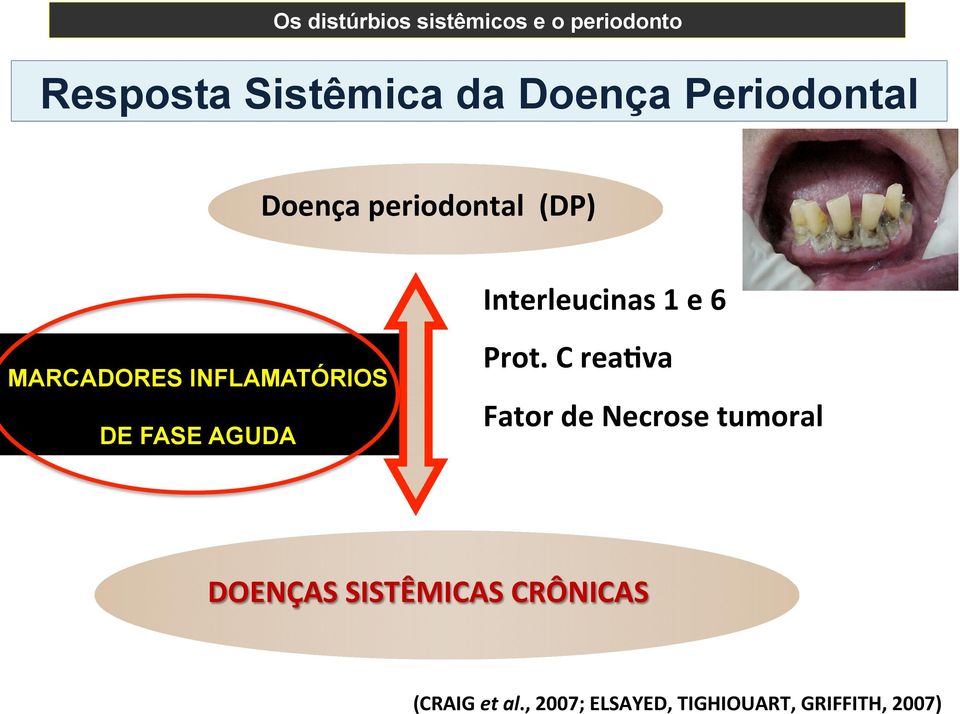 o periodonto Resposta Sistêmica da Doença Periodontal Doença periodontal