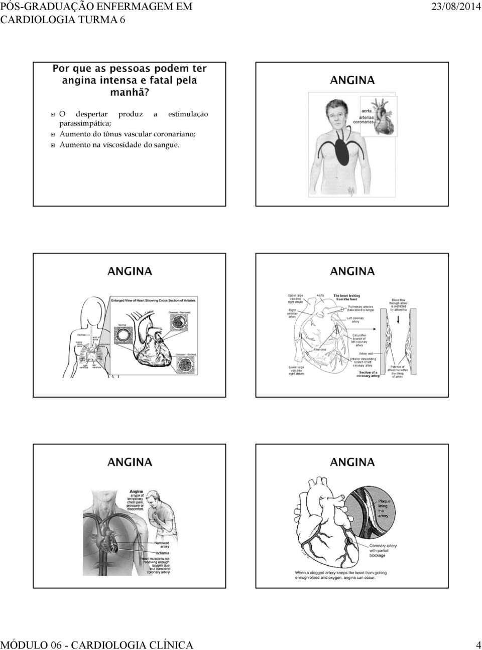 vascular coronariano; Aumento na