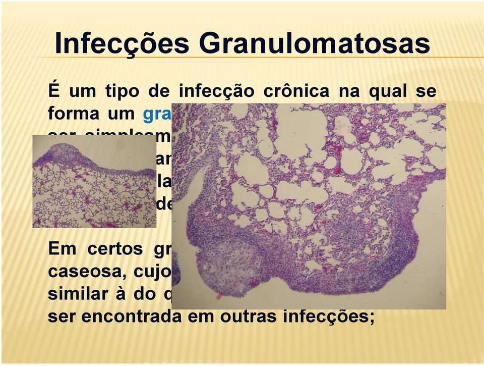 outras células inflamatórias, com maior capacidade de fagocitose; Em certos granulomas, ocorre a