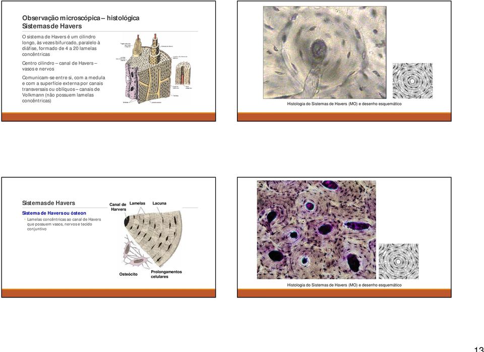 Volkmann (não possuem lamelas concêntricas) Histologia do Sistemas de Havers (MO) e desenho esquemático Sistemas de Havers Sistema de Havers ou ósteon Lamelas concêntricas
