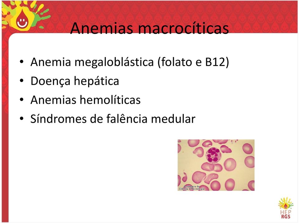 Doença hepática Anemias