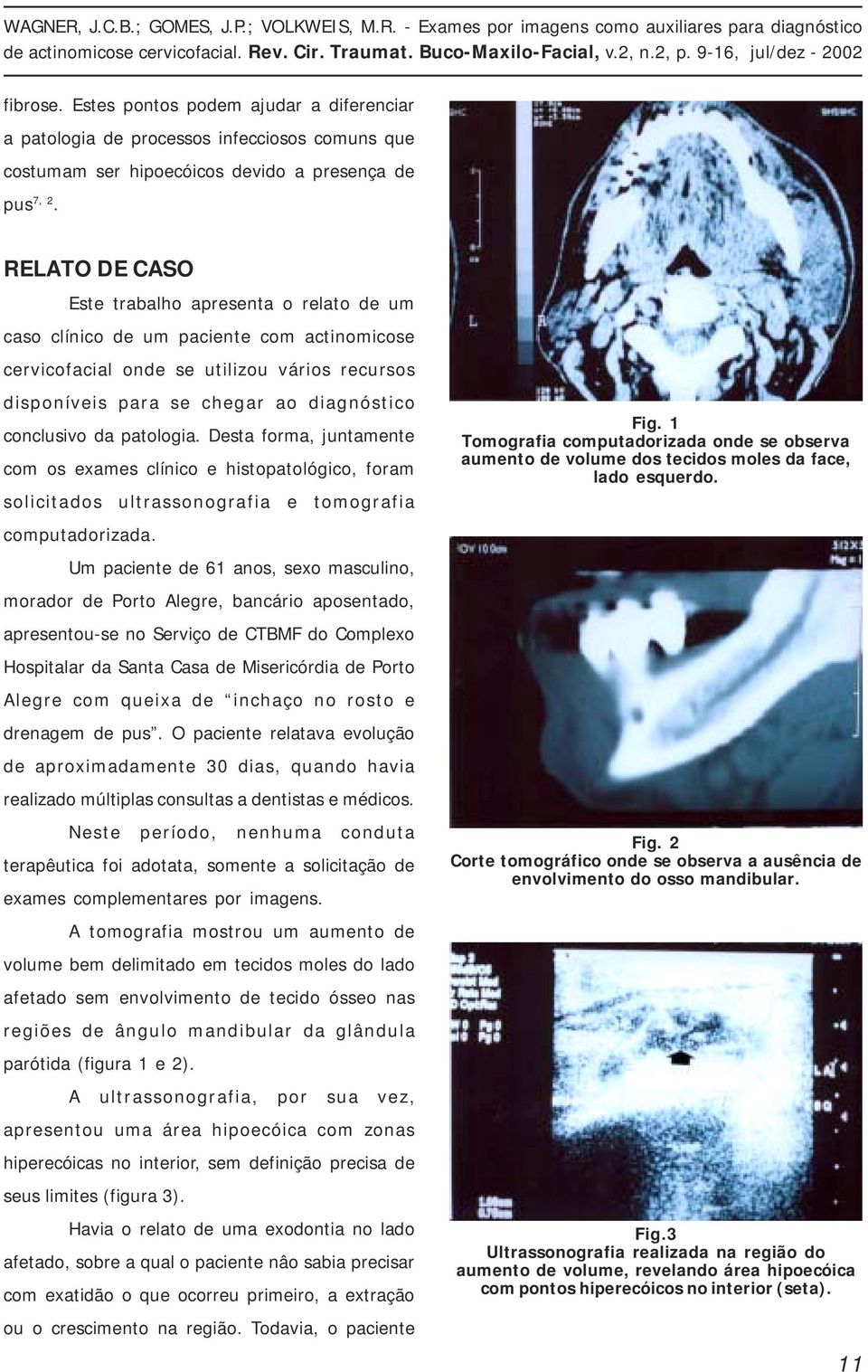 da patologia. Desta forma, juntamente com os exames clínico e histopatológico, foram solicitados ultrassonografia e tomografia computadorizada.