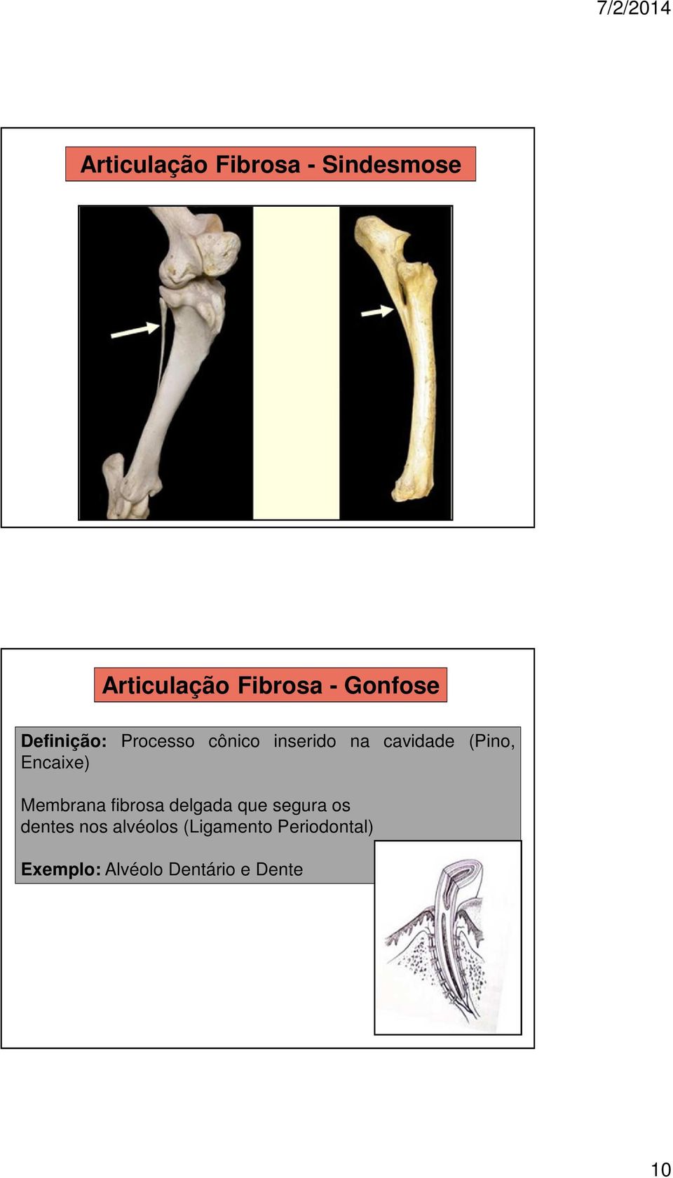 (Pino, Encaixe) Membrana fibrosa delgada que segura os dentes