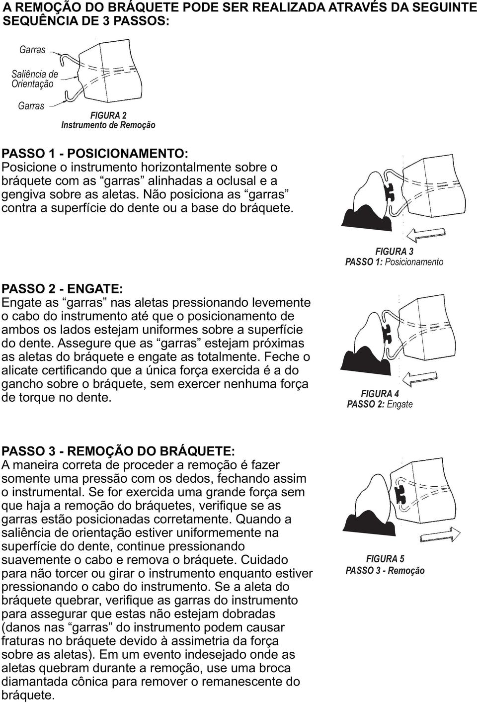 FIGURA 3 PASSO 1: Posicionamento PASSO 2 - ENGATE: Engate as garras nas aletas pressionando levemente o cabo do instrumento até que o posicionamento de ambos os lados estejam uniformes sobre a