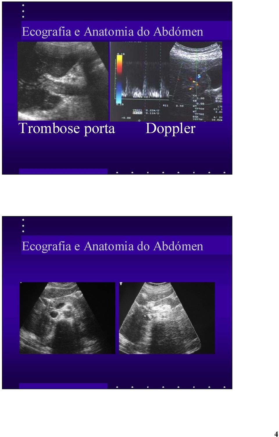 porta Doppler  do