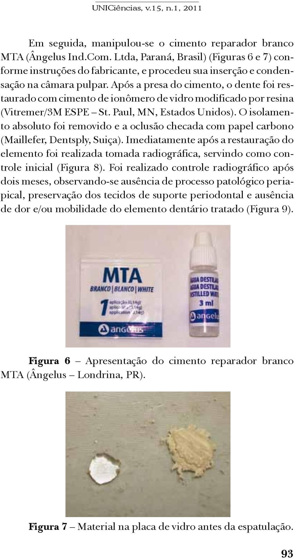 Após a presa do cimento, o dente foi restaurado com cimento de ionômero de vidro modificado por resina (Vitremer/3M ESPE St. Paul, MN, Estados Unidos).