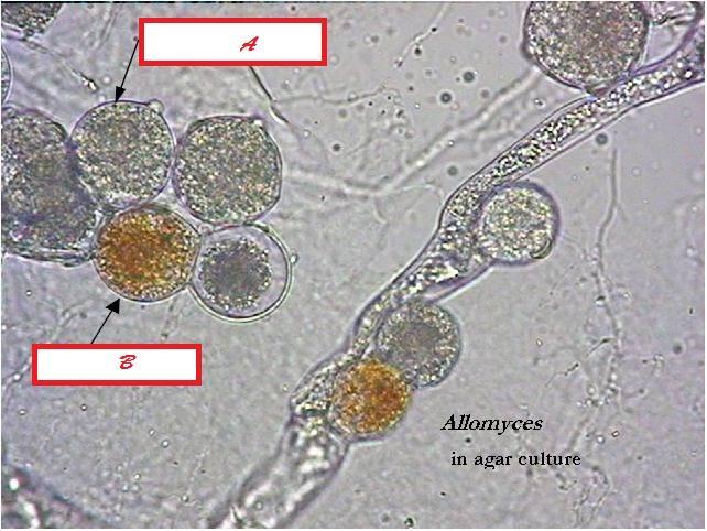 Filo Blastocladiomicetos Vivem na água doce e solo úmidos Alimentam-se de detritos -