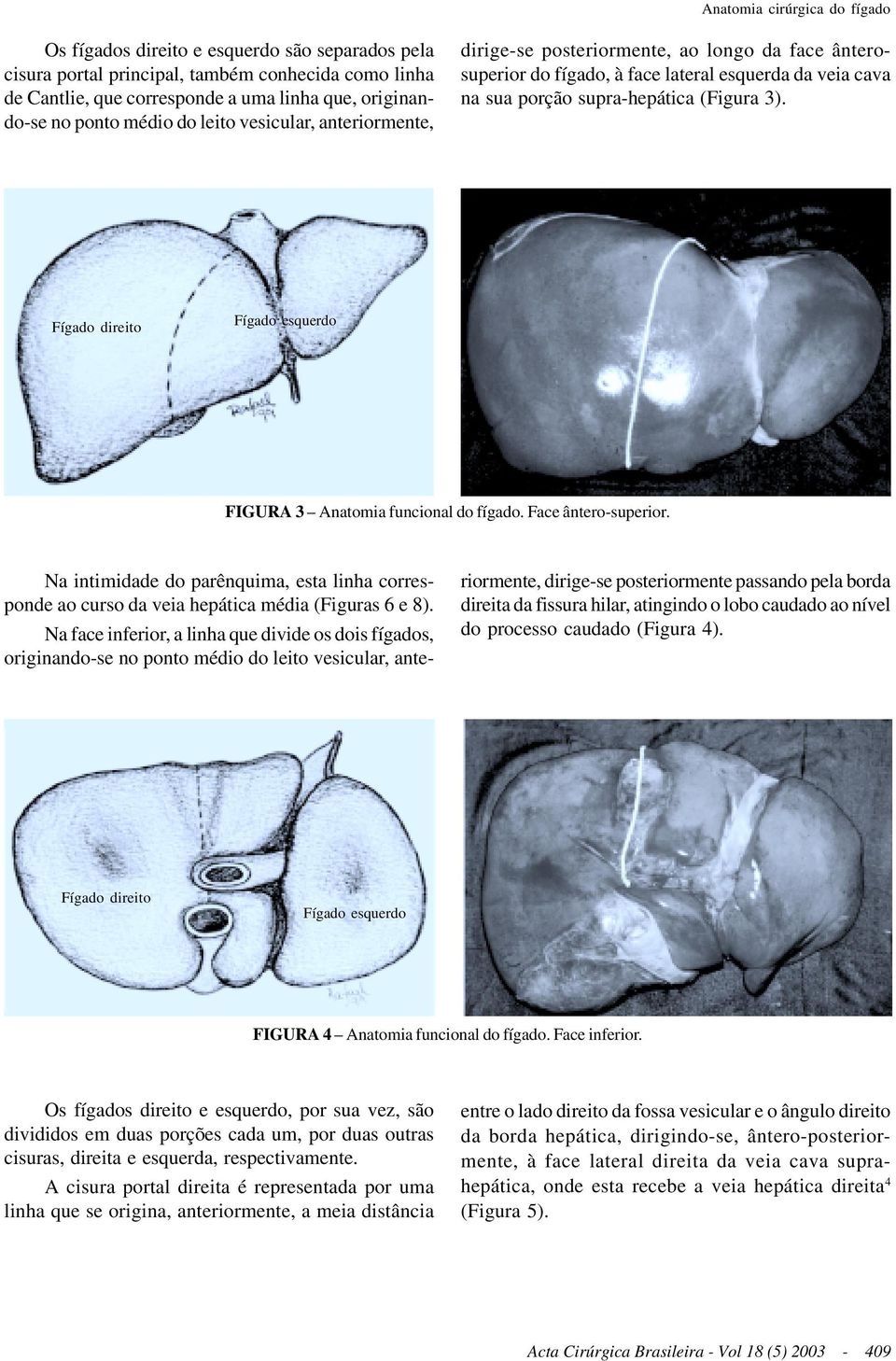 Fígado direito Fígado esquerdo FIGURA 3 Anatomia funcional do fígado. Face ântero-superior. Na intimidade do parênquima, esta linha corresponde ao curso da veia hepática média (Figuras 6 e 8).