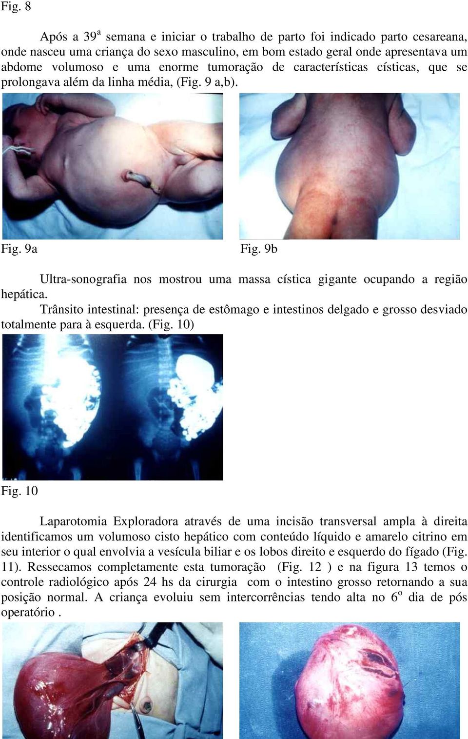 Trânsito intestinal: presença de estômago e intestinos delgado e grosso desviado totalmente para à esquerda. (Fig. 10) Fig.