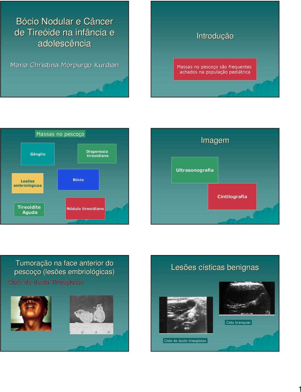 Ultrasonografia Lesões embriológicas Bócio Cintilografia Tireoidite Aguda Nódulo tireoidiano Tumoração na face anterior