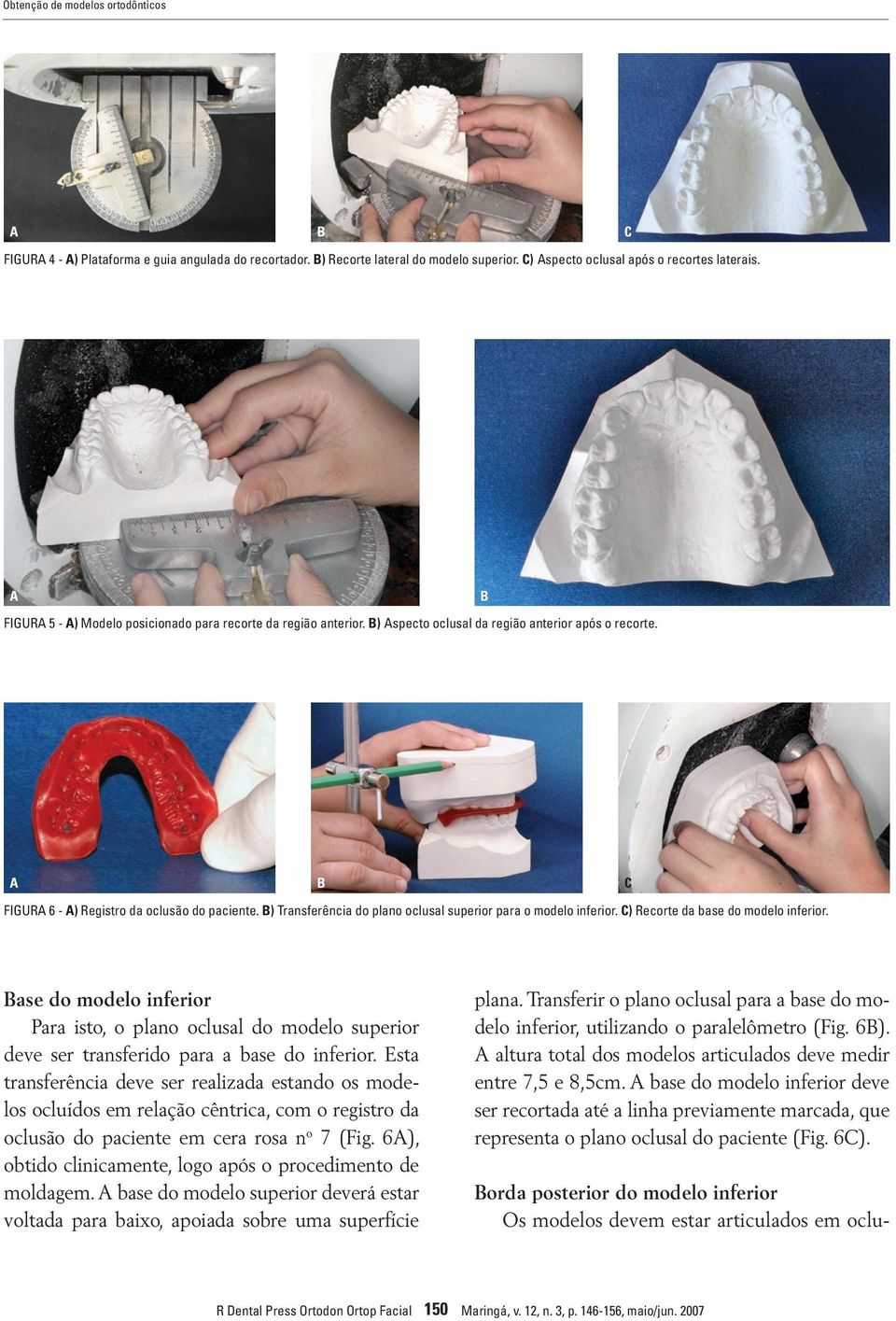 ) Transferência do plano oclusal superior para o modelo inferior. C) Recorte da base do modelo inferior.