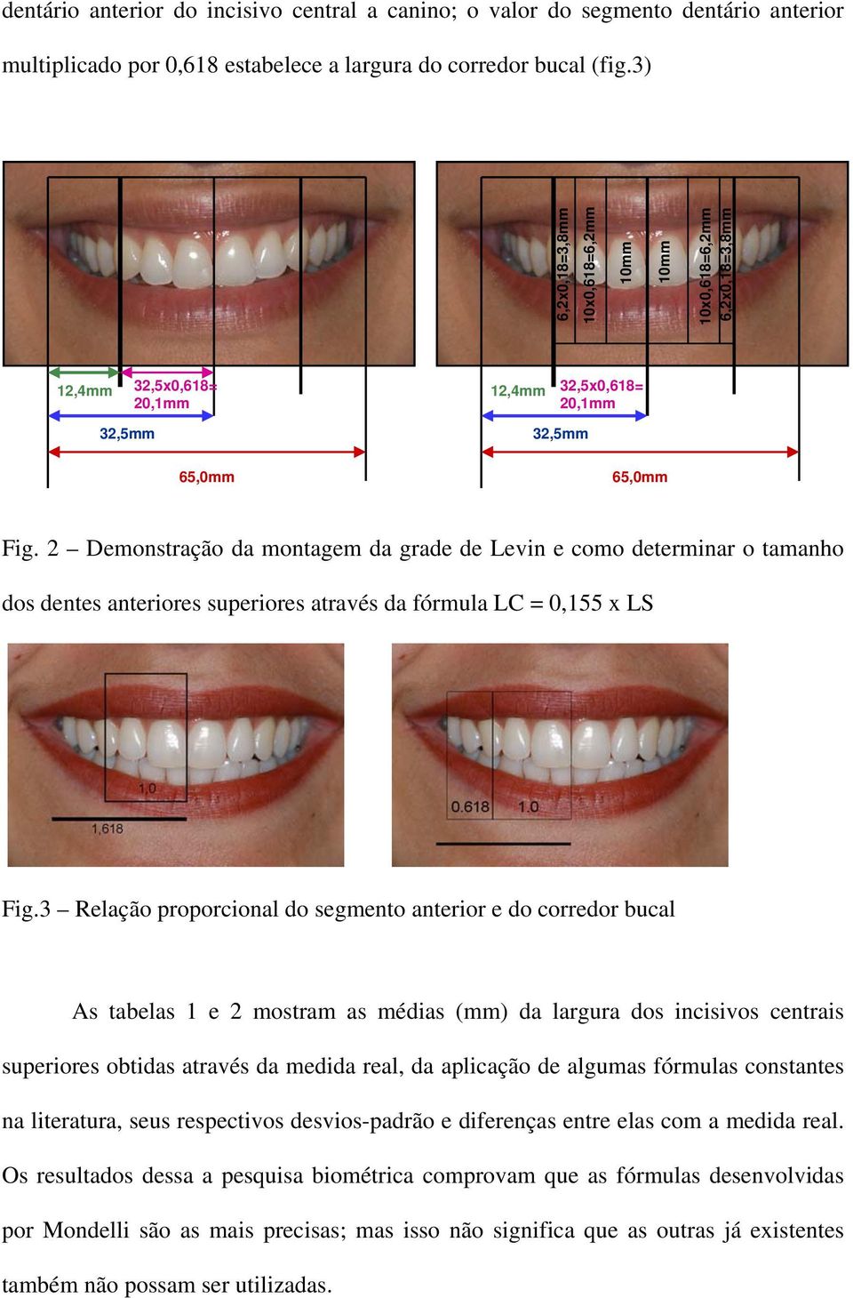 2 Demonstração da montagem da grade de Levin e como determinar o tamanho dos dentes anteriores superiores através da fórmula LC = 0,155 x LS Fig.