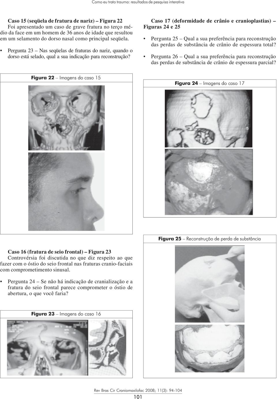 Caso 17 (deformidade de crânio e cranioplastias) Figuras 24 e 25 Pergunta 25 Qual a sua preferência para reconstrução das perdas de substância de crânio de espessura total?