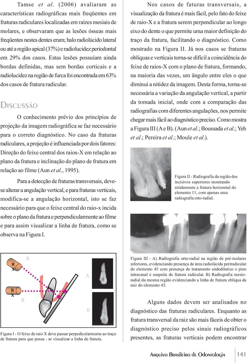 eram; halo radiolúcido lateral ou até a região apical (37%) e radiolucidez periodontal em 29% dos casos.