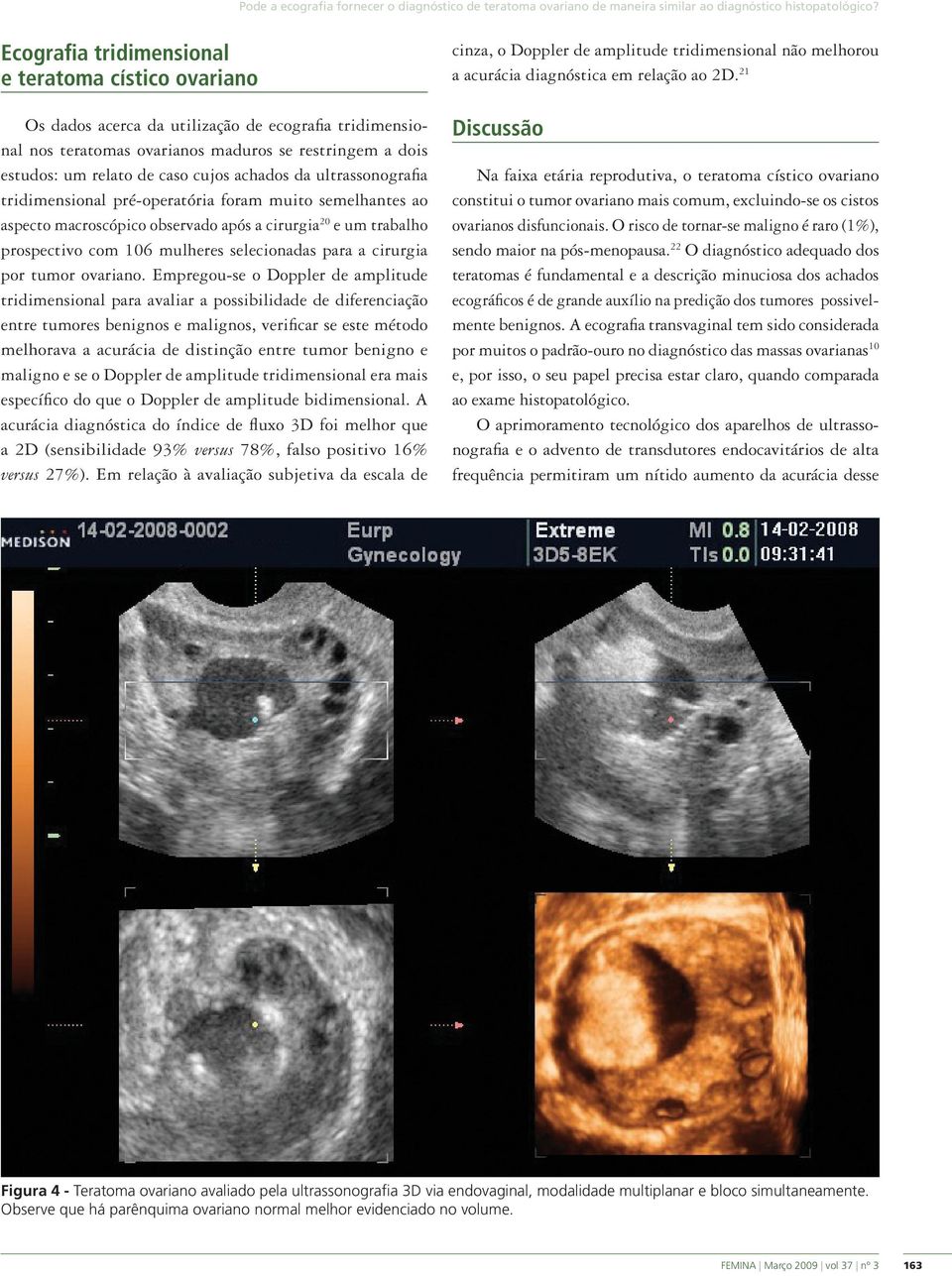 achados da ultrassonografia tridimensional pré-operatória foram muito semelhantes ao aspecto macroscópico observado após a cirurgia 20 e um trabalho prospectivo com 106 mulheres selecionadas para a