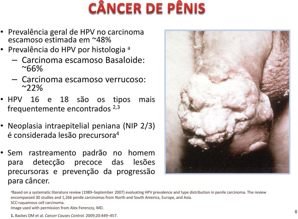 progressão para câncer. a Based on a systematic literature review (1989 September 2007) evaluating HPV prevalence and type distribution in penile carcinoma.